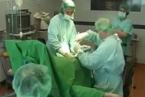 Pênis aumentam a operação